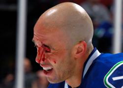 Photo hockey Canucks: Malhotra en chirurgie - NHL : National Hockey League - AHL