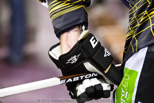Strasbourg  5 - 1 Rouen